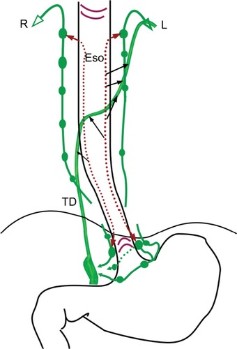 Figure 3 Schema of direction of esophageal lymphatic drainage.Notes: The submucosal lymphatic drainage is bidirectional while extramural lymphatic drainage should be unidirectional. Black arrows indicate direct drainage to TD from submucosa.Abbreviations: ESO, esophagus; L left; R right; TD, thoracic duct.