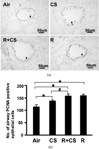 Figure 4 CS and roflumilast increase PCNA expression in airway epithelium. PCNA expression in airway epithelial cells was detected by immunohistochemistry in paraffin-embedded lung sections. (A) Representative lung photomicrographs of PCNA immunostaining. Air: air control; CS: cigarette smoke alone; R+CS: roflumilast plus CS; R: roflumilast alone. Arrows indicate positive cells. Internal scale bar = 50 μ m. (B) PCNA expression was assessed as number of positive epithelial cells per mm airway basement membrane. Values are presented as mean± SEM. *: p < 0.05 versus Air. #: p < 0.05 versus CS.