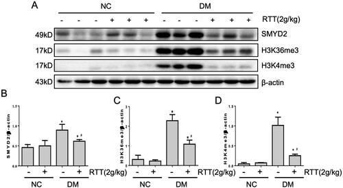 Figure 6. RTT extract inhibited SMYD2 in STZ-induced diabetic mice. (A) Kidney tissue lysates were subjected to western blot analysis with antibodies against SMYD2, H3K36me3 or H3K4me3 in STZ-induced diabetic mice after 28 weeks of RTT extract (2 g/kg) treatment (n = 12); Protein expression levels of SMYD2 (B); H3K36me3(C); H3K4me3 (D) were normalized with β-actin (n = 12, means ± SD, *p < 0.05 vs. NC group; #p < 0.05 vs. DM group).