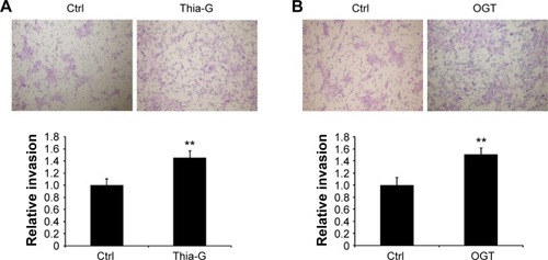 Figure 3 Up-regulation of O-GlcNAcylation enhances the invasion of thyroid anaplastic cancer cells in vitro.