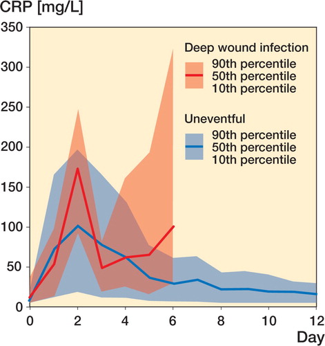 Figure 2. Time‐dependent reference limits (median, and tenth and ninetieth percentiles) after uneventful operative fracture treatment (black) and in the 17 cases of deep wound infection (red).