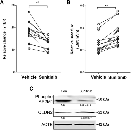 Figure 10. Role of AP2M1 in human colonic TJ barrier. Sunitinib (25 µM, 18 h) significantly decreased TER (A) and increased urea flux (B) in human colonic mucosal samples. N = 15, (*, p < 0.001 versus vehicle). (C) Sunitinib treatment reduced phospho-AP2M1 levels and increased CLDN2 levels in human colonic mucosal samples. The numbers below the individual bands indicate densitometry in terms of phospho-AP2M1:ACTB and CLDN2:ACTB ratio. (*, p < 0.01 versus vehicle) .