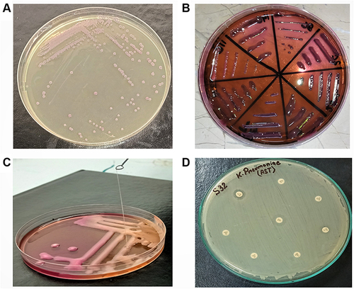 Figure 1 (A) purified purple colonies of K. pneumoniae on Klebsiella selective agar. (B) Pink mucoid colonies of K. pneumoniae on MacConkey agar. (C) Identification of hypervirulent phenotype through string test. (D) Results of Antimicrobial Susceptibility testing (AST) by disk diffusion method.