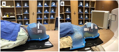 Figure 1 Patient Immobilization: (A) Head and neck (HN) mask and type B headrests. (B) Head-neck-shoulder (HNS) mask and type C headrest.