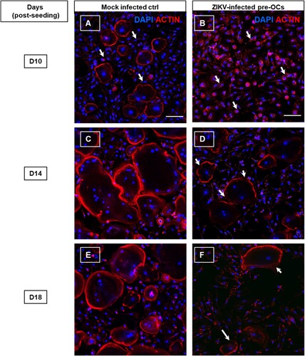 Figure 7. Immunofluorescence staining of ZIKV infected pre-OCs actin dynamics. Pre-OCS were infected with ZIKV (moi = 5) on day 3 post cell culturing. At the indicated time post cell culturing, ZIKV infected and mock infected cells were fixed, permeabilized and stained for actin with rhodamine-conjugated phalloidin (red) and nuclei (DAPI, blue) for selected time points such as day 10 (A-B), day 14 (C-D) and day 18 (E-F) post cell culturing. The arrows in the images indicate the actin organization in cytoplasm in the mononucleated OCs in (A) mock- and (B) ZIKV infected pre-OCs. (D, F) Arrows indicate the breaks in the actin rings towards the periphery of ZIKV infected pre-OCs.