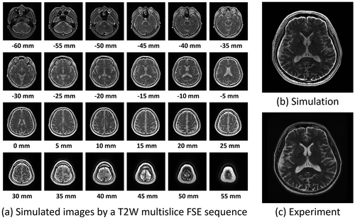 Figure 13. (a) 2D cross-sections simulated with the T2 weighted multislice FSE sequence (TR = 4800 ms, TE = 96 ms, echo train length (ETL) = 8, echo spacing = 12 ms). The images were calculated from 51,823,104 isochromats using BlochSolver [Citation73]. The computation time was about 24 minutes using a GPU (GeForce RTX 2080Ti, NVIDIA, Santa Clara, USA). (b) The 2D cross-section selected from the multislice FSE images of (a). (c) The 2D cross-section selected from the image dataset acquired with the T2 weighted multislice FSE sequence (TR = 5272 ms, TE = 103 ms, ETL = 20) at 3 T