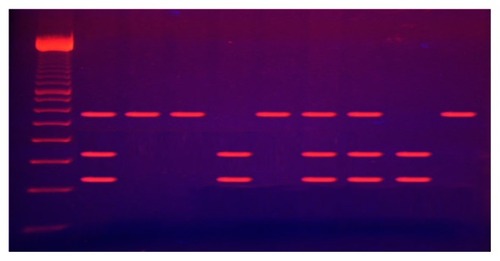 Figure 1 Electrophoresis of digested ITGA2 (BgI II) polymerase chain reaction products.