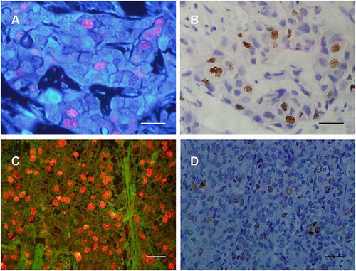 Full article: Quantum Dot-Based Immunofluorescent Imaging of Ki67 and ...