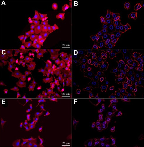 Figure 6 Fluorescence microscopy (FM) images of free shikonin (SHK) effects in OVCAR-5 cells.Notes: (A) FM image of the untreated cells. (B) Stylized image of the untreated cells. (C) FM image of the treated cells with 5.0 μM SHK. (D) Stylized image of the treated cells with 10.0 μM SHK. (E) FM image of the treated cells with 20 μM SHK. (F) Stylized image of the treated cells with 20.0 μM SHK.