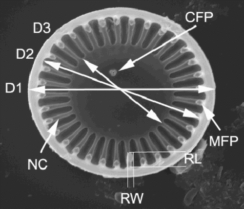 Fig. 1. Variables used for the conventional morphometric analyses, illustrated on a C. meneghiniana valve. D1 – valve diameter; D2 – valve diameter measured between the inner edges of the mantle (i.e., D1 minus twice the mantle thickness); D3 – diameter of the central area; RW – width of the rimoportula; RL – length of the rimoportula; NC – number of costae; MFP – number of marginal fultoportulae; CFP – number of central fultoportulae.