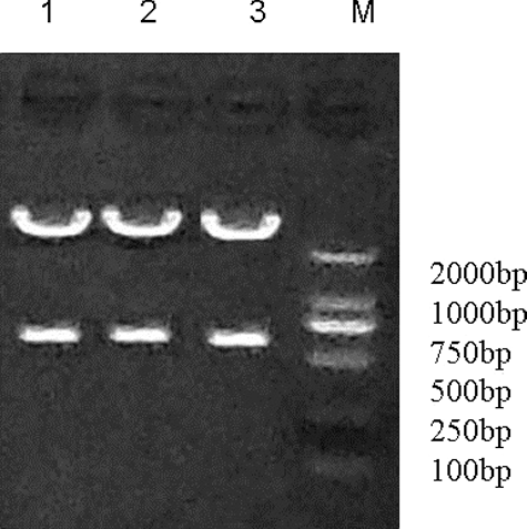 Figure 1. Band of the pYr-1.1-Cav3.3 shRNA plasmid digested with BsaI. Lane 1: pYr-Cav3.3 shRNA1; Lane 2: pYr-Cav3.3 shRNA2; Lane 3: pYr-Cav3.3 shRNA3; M: molecular size marker (Thermo Fisher Scientific Inc., Waltham, MA, USA).