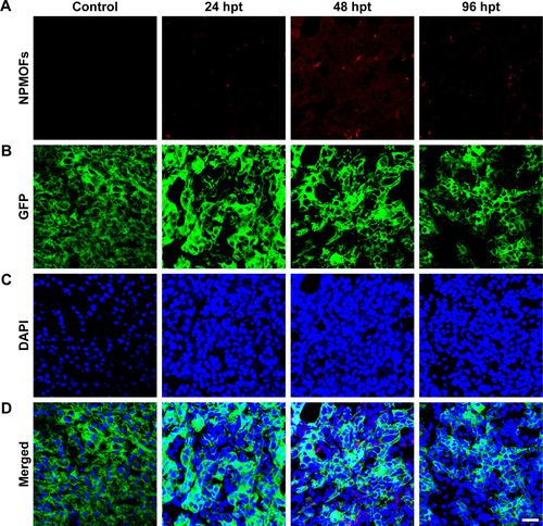 Figure S7 Time-lapse retention of NPMOFs in the liver of HCC-bearing zebrafish.Notes: (A) Retention of NPMOFs in the liver of HCC-bearing zebrafish at 0 hours post treatment (hpt; control), 24, 48, and 96 hpt. (B) Images of GFP fluorescence and (C) DAPI staining in the same liver from (A). (D) Merged images of (A–C). Scale bar: 20 µm.Abbreviations: GFP, green fluorescent protein; HCC, hepatocellular carcinoma; hpt, hours post treatment; NPMOF, nanoscale gadolinium-porphyrin metal-organic framework.