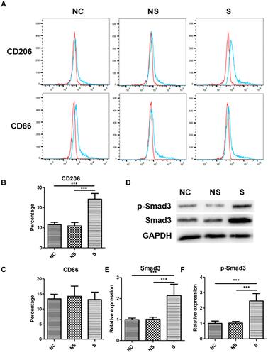 Figure 4 The phenotype in THP-1 macrophages under stimulations of serum with different origins. (A) The representative image of flow-cytometry of CD206 expression and CD86 expression in THP-1 macrophages with different stimulations. (B) The quantification of CD206 expression in THP-1 macrophages with different stimulations. (C) The quantification of CD86 expression in THP-1 macrophages with different stimulations. (D) The expression of Smad3 and p-Smad3 in THP-1 macrophages with different stimulations, and related quantification (E and F). N=7. ***p<0.001.