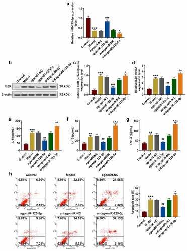 Figure 2. Effects of miR-125-5p overexpression on co-culture system of monocyte cells (THP-1) and human intestinal epithelial cells (NCM460). (a) After co-cultivation of THP-1 and NCM460 for 24 hours, the expressions of miR-125-5p in THP-1 cells of the Control, Model, agomiR-NC, agomiR-125-5p, antagomiR-NC, and antagomiR-125-5p groups were detected by reverse transcription real-time quantitative polymerase chain reaction (RT-qPCR). (b-d) After co-culture of THP-1 and NCM460 for 24 hours, the expression of IL-6 R in THP-1 cells of each group was detected by RT-qPCR and Western blot. (e-g) Enzyme-linked immunosorbent assay (ELISA) was used to determine the contents of interleukin-6 (IL-6), IL-1β and tumor necrosis factor-α (TNF-α) in the supernatant of medium in each group. (h) After 24-h co-culture of THP-1 and NCM460, the apoptosis of NCM460 cells was detected by flow cytometry. All the experiments have been performed in triplicate. β-actin and U6 were used as controls, respectively. ** P < 0.01, *** P < 0.001 vs. Control; ## P < 0.01, ### P < 0.001 vs. agomiR-NC; ^ P < 0.05, ^^ P < 0.01, ^^^ P < 0.001 vs. antagomiR-NC