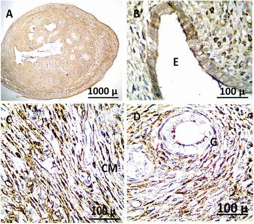 Figure 13. Immunohistochemistry showing caspase-3 streptavidin-biotin- peroxidase staining method in the uterus of adult female rat treated with (2 mg/kg of AgNps) low dose showing positive and moderate expression of immune stain caspase-3.