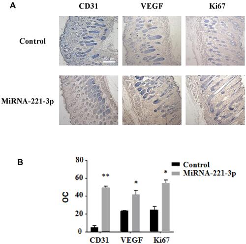 Figure 8 Immunohistochemical staining of miRNA-221-3p–treated skin wound tissue in diabetic mice. Representative immunohistochemical images (A) and summary data (B) showing immunostaining in the skin wound tissue from diabetic mice treated with miRNA-221-3p (expressed as integrated optical density/total area; OC) (magnification, 200×). All values are presented as means and standard deviations (n = 3). Statistically significant differences are indicated by *P < 0.05 and **P < 0.01, compared with the control group treated with PBS.