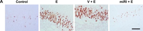 Figure 3 miR-210 inhibitor prohibited epilepsy-induced neuronal apoptosis.