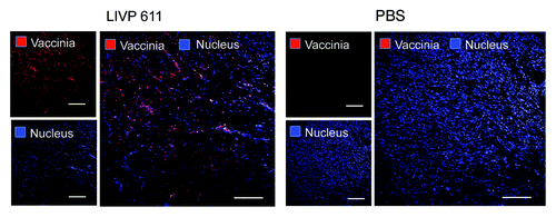 Figure 4. Immunohistochemical staining of infected and uninfected STSA-1 xenograft tumors at 35 dpvi. Tumor-bearing mice were either mock treated (PBS) or infected with LIVP6.1.1. Tumor sections were labeled with anti-vaccinia virus antibodies (red) and nuclei were stained with Hoechst (blue). Scale bars, 2.5 mm.