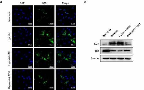 Figure 4. Effect of LRG1 on autophagy. (a) Autophagy was detected by immunofluorescence assay (the scale bars = 50 μm); (b) LC3 and p62 protein expression were detected by western blot