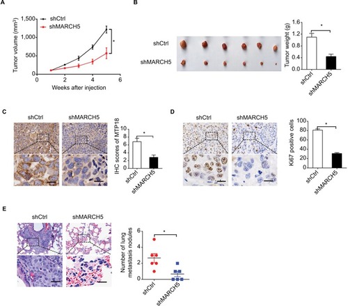 Figure 4 Knockdown of MARCH5 suppressed breast cancer growth and metastasis in vivo.Notes: (A) Growth of subcutaneous xenografts established from MDA-MB-231 cells with stable MARCH5 knockdown or control cells. shMARCH5, shRNA expression vector against MARCH5; shCtrl, control shRNA. (B) The weight of tumors dissected from mice was compared between the shMARCH5 and shCtrl groups. (C and D) The expression levels of MARCH5 and Ki-67 were detected by IHC analysis in the two groups of subcutaneous xenografts tumors. Scale bars, 10 µm. (E) Representative images and numbers of lung metastatic foci in each group are shown. Scale bars, 10 µm. *P<0.05.