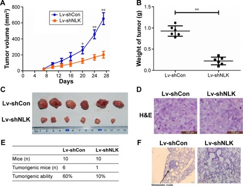 Figure 7 Downregulation of NLK inhibited tumor growth and lung metastasis in vivo.