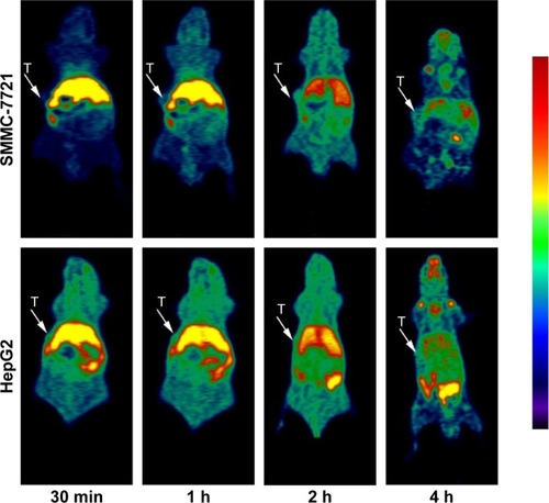 Figure 5 Dynamic small-animal PET scans obtained for [18F]fluoroethyl bufalin with SMMC-7721 T-bearing mice and HepG2 T-bearing mice.