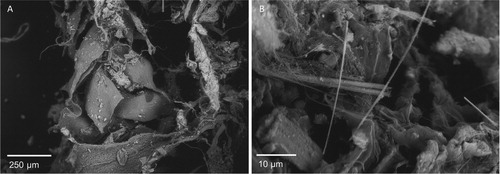Figure 6. Overview of some moss leaves (A) and (B) asbestos fibers can be found tangled in the moss sample.