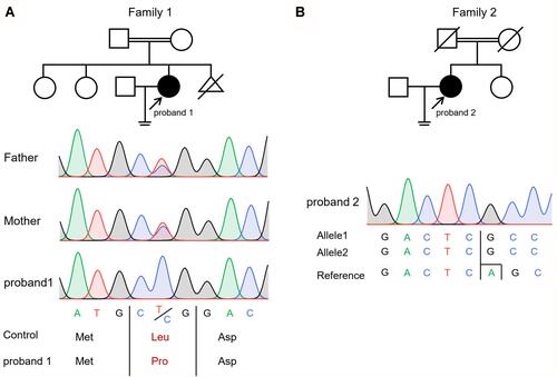 Figure 1 (A) Pedigree of the family 1 and Sanger sequencing chromatogram of proband 1 and her parents. A novel variant DNAAF2 c.419T>C, p.(Leu164Pro) was identified in the proband. Her parents were heterozygous at the same position. (B) Pedigree of the family 2 and Sanger DNA sequencing chromatogram of proband 2. A novel variant DNAAF2 c.822delA, p.(Ala275Profs*10) was identified in the proband. Circles indicate to females. Squares indicate males. Solid symbols indicate patients. Crossed-out symbols mean that subjects had passed away. The arrows indicate the probands. The vertical line with 2 hash marks at the end indicates infertility.