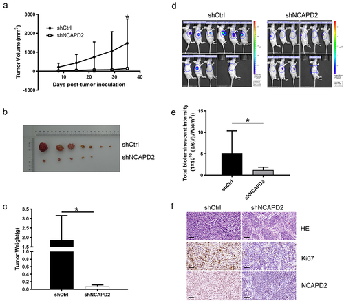 Figure 6. NCAPD2 knockdown suppressed tumor growth in vivo. (a) Tumor volumes were measured in animal models. (b) Representative photos of tumors. (c) Tumor weights were measured after euthanizing the mice. (d) Fluorescence expression of xenograft tumors in nude mice in the shCtrl and shNCAPD2 groups. (e) Fluorescence expression of xenograft tumors in the two groups. (f) Representative images of sections of the indicated tumors and stained with hematoxylin and eosin staining (upper panel), anti-Ki67 (middle panel), and immunohistochemical staining for NCAPD2 (lower panel). Scale bar: 100 μm. Data are presented as mean ± SD (n = 3), *p < 0.05.