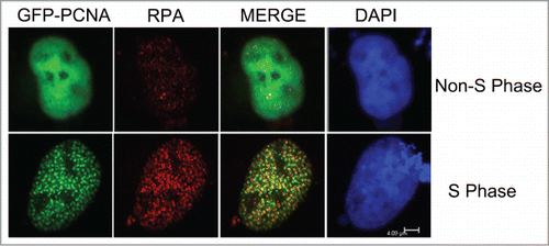 Figure 2. Co-localization of GFP-PCNA with endogenous RPA during S-phase. The GFP-PCNA expression vectors were transiently transfected into Cos-E5 cells. Twenty-four hours after transfection, cells were immune-stained with anti-RPA70 and visualized with Alexa Flour594 Goat Anti-Rabbit IgG (red) and GFP-PCNA (green) by confocal fluorescent microscopy. Co-localization of the 2 proteins (merge) showed largely overlapping signals as yellow colored replication foci. The scale bar was at 4.09 μm.