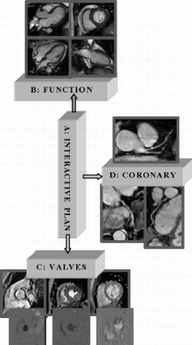 Figure 1. “Quick CMR Screening” protocol of myocardial function, valves, and coronary arteries.