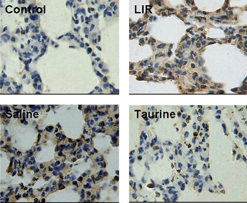 Figure 4.  Effect of taurine on apoptosis: TUNEL staining for apoptosis in lungs from different groups.