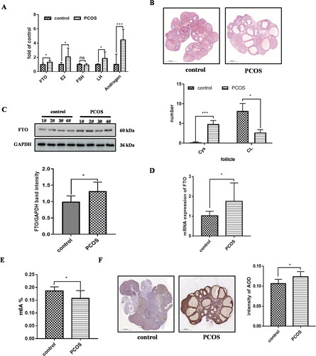 Figure 2. FTO expression was increased in PCOS model in vivo. A secretion levels of FTO and hormones in serum in PCOS rat and control (control, n = 8; PCOS, n = 8). B ovary sections stained by hematoxylin-eosin. The number analysis of cystic follicles (Cys) and corpora lutea (CL)in PCOS rat and control. C FTO protein level of the ovary of PCOS rat and control by Western blot, band intensity was calculated by Image J. D FTO mRNA expression in the ovary of PCOS rat and control. E the m6A content in the ovary of PCOS rat and control. F FTO protein level of the ovary of PCOS rat and control by immunocytochemistry. Scale bar, 500 μm. Average optical density (AOD) was analyzed by Image-pro plus. Data are presented as the mean ± SD. *p < .05, **p < .01, ***p < .001.