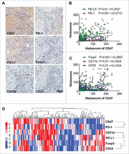 Figure 2. Overexpression of CD47 in human HNSCC is associated with inhibitory checkpoints and suppressive immune cell. (A) Representative immunohistochemical staining of CD47, PD-1, PD-L1, Foxp3, CD11b and CD33 in human HNSCC specimens. Scale bar, 25 μm. (B) The expression of CD47 was positively correlated with PD-1 (P<0.001, r = 0.2715) and PD-L1 (P <0.01, r = 0.2527). (C) The expression of CD47 were positively correlated with Foxp3 (P<0.001, r = 0.2857), CD11b (P<0.01, r = 0.2424) and CD33 (P<0.01, r = 0.2154) in human HNSCC. (D) Hierarchical clustering indicated a close relation of CD47 with PD-1 in primary HNSCC. (statistic including 165 primary HNSCC).