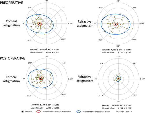 Figure 3 Double-angle plots for preoperative and postoperative corneal and refractive astigmatism. Centroids and mean absolute values with standard deviations are also shown.