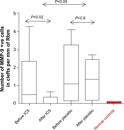 Figure 7 MMP-9 expression in Rbm.