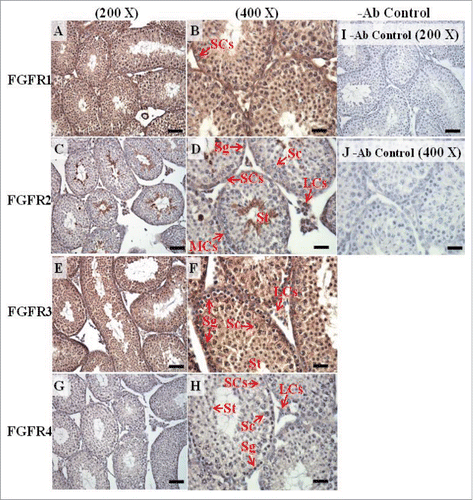 FIGURE 11. The expression patterns of FGFR1, FGFR2, and FGFR3 on postnatal day (pnd) 35 in mice testis. The expression patterns of FGFR1 (A and B), FGFR2 (C and D), FGFR3 (E and F), and FGFR4 (G and H) on pnd 35 mice testis were detected using immunohistochemistry. Control sections without a primary antibody treatment are arranged on right side of the figure (I and J). The long arrow indicates the cell types as illustrated by the abbreviations: LCs, Leydig cells; MCs, myoid cells; SCs, Sertoli cells; Sg, spermatogonia; Sc, spermatocyte; and St, spermatids. Scale bar = 50 µm (200 ×) and 19 µm (400 ×).