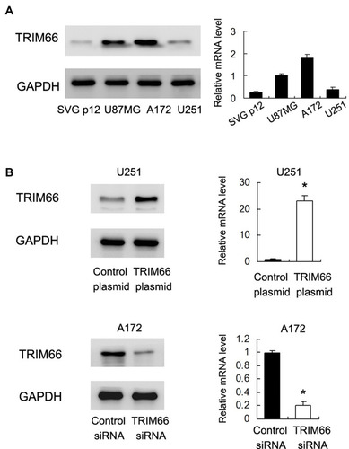 Figure 3 TRIM66 expression in glioma cell lines. (A) Western blot and RT-qPCR results showed that TRIM66 protein was low in normal glial cell line SVG p12. TRIM66 showed high expression in glioblastoma cell lines U87MG and A172. (B) Transfection and siRNA knockdown efficiencies were confirmed by Western blot and RT-qPCR in U251 and A172 cells, respectively. *p<0.05.