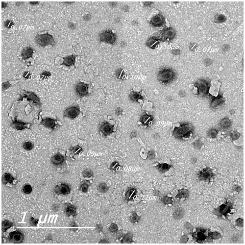 Figure 5. Transmission electron micrograph of the KP-SLN dispersion. The black dots represent KP-SLN, the gray dots and background represents the dispersion medium stained by phosphotungstic acid.