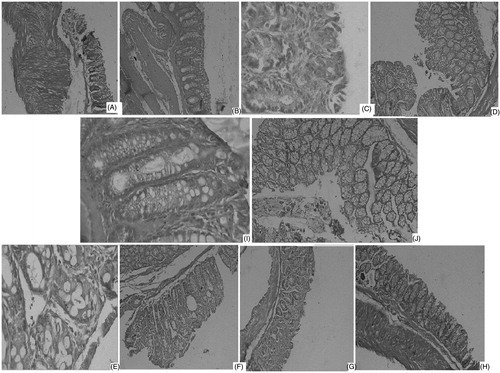Figure 1. Histological colonic mucosal sections of mice receiving treatment of (A) chloroform extract (100 mg/kg), (B) chloroform extract (200 mg/ml), (C) ethyl acetate extract (100 mg/kg), (D) ethyl acetate extract (200 mg/ml), (E) ethanol extract (100 mg/kg), (F) ethanol extract (200 mg/ml), (G) aqueous extract (100 mg/kg), (H) aqueous extract (200 mg/ml) showing maximum beneficial effects in terms of attenuation of the morphological disturbance, reduction of the inflammatory cell infiltration, and mucosal edema associated with DNBS administration, (I) prednisolon 5 mg/kg showing attenuation of the extent and severity of cell damage, (J) DNBS infusion (5 mg/mice) showing inflammatory cell infiltration and mucosal edema, disorganized epithelial layer associated with DNBS administration.
