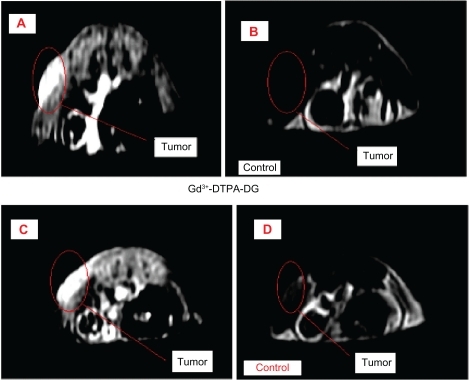 Figure 9A Magnetic resonance images (T1 weighted method) prior and 20 minutes after Gd3+-DTPA-DG intravenous injection (A and B) in mice bearing human lung cancer (each image was performed on three mice). The tumor site was definitely enhanced. Magnetic resonance images (T1 weighted method) 20 minutes post Gd3+-DTPA + Gd3+-DTPA-DG (C) and Gd3+-DTPA (Magnevist®, D) intravenous injection in mice bearing human lung cancer.Abbreviations: Gd3+-DTPA-DG, gadopentetate dimeglumine-D-deoxy-glucosamine; Gd3+-DTPA, gadopentetate dimeglumine.