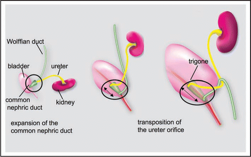 Figure 4 The original model of ureter insertion. Left: The ureter joins the bladder indirectly via the common nephric cut. Middle: The common nephric duct inserts into the bladder and expands, moving the ureter orifice anterior with respect to the Wolffian duct. Right: Further expansion of the trigone positions the ureter orifice in its final insertion site.