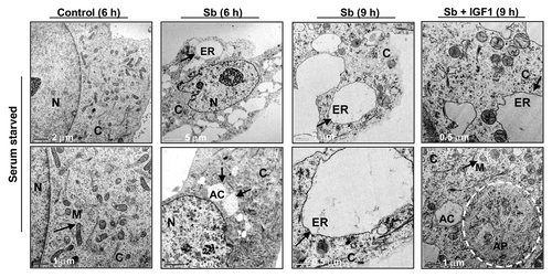 Figure 4. Visualization of autophagy induction and cellular morphology under transmission electron microscopy (EM) after treatment of SW480 cells with silibinin under serum-starved conditions. All experimental procedures and statistical analysis were performed as detailed in Materials and Methods. N, nucleus; C, cytoplasm; ER, endoplasmic reticulum with ribosomes as beads on membrane; M, mitochondria; AC, autophagic compartment; AP, autophagosomes.