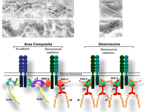 Figure 2. Molecular organization of area composita vs. desmosome in the heart. (a) Immunoelectron microscopic images of the myocardium of a mouse heart showing the co-localization of PKP2 and αT-catenin at the area composita. Note the absence of αT-catenin in the desmosome. These images were originally published in a study by CitationGoossens et al. (2007). (b) Model for cadherin-based cell–cell adhesion in the heart. This model represents the composition of a hybrid junction compared to a desmosome. αT-Catenin recruits desmosomal proteins through its interaction with plakophilin-2 (PKP2), forming a hybrid junction (named area composita), reinforcing the intercalated discs resistance. (αE: αE-catenin; αT: αT-catenin; β-cat: β-catenin; PG: plakoglobin; PKP2: plakophillin-2; IF: intermediate filaments).