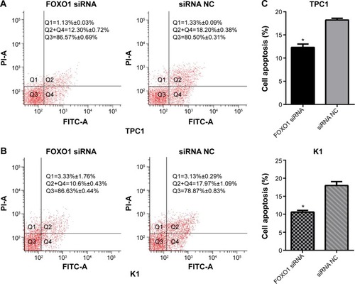 Figure 5 Knockdown of FOXO1 reduced 5-FU-induced apoptosis of PTC cells. After 24 hours transfection with FOXO1 siRNA or NC RNA (200 nmol/L), apoptosis of TPC1 and K1 cells was induced by 5-FU (10 mmol/L) for 36 hours, then measured by flow cytometry. Q2+Q4 represents apoptotic cells (%).