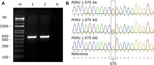 Figure 1 PON1 c.575A>G genotypification. (A) Agarose gel electrophoresis of amplicon products generated by PCR. (B) Sanger sequencing chromatogram showing the PON1 c.575A>G genotypes.