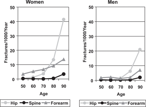 Figure 1 The incidence of forearm, symptomatic vertebral and hip fractures in men and women from Cardiff (CitationJohansen et al 1997).