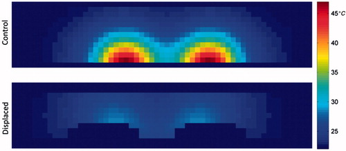 Figure 9. Resulting temperature distribution at t = 1800 s, y = 0 cm, for the control and displaced phantoms.