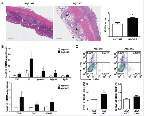 Figure 6. Inflammation and Th1 skewing in the colon of Atg7 cKO mice. (A) Colitis score was calculated on d 7 of DSS treatment as described in Materials and Methods (n = 5 each) (right). Representative H&E sections are shown (left, scale bar: 200 μm) (asterisk, inflammation; arrow, ulceration; arrow head, regeneration; white arrow, transmural lesion). (B) Relative expression of cytokines and chemokines in the colonic tissues on d 7 of DSS treatment assessed by quantitative RT-PCR analysis of mRNA prepared using a formalin-fixed paraffin-embedded extraction kit (n = 8 to 10). (C) Th skewing in the colonic lamina propria on day 7 of DSS treatment was evaluated by flow cytometry. The proportions of IFNG+ cells and IL17A+ cells among CD3E+ CD4+ T cells (lower) (n = 4 each). Representative scattergrams are shown (upper). *, P < 0.05.