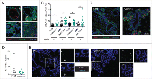 Figure 3. Increase in proliferation rate, but not cell death, in PyMT/Il1r1−/− mice at early time points. (A) PyMT or PyMT/Il1r1−/− mice at 10 weeks of age were injected i.p. with BrdU 2 h before sacrifice. Epifluorescence images of mammary fat pad were stained with antibodies against BrdU and EpCAM. Mammary ducts were classified into four different grades (grade 0 = healthy, grade 1 = hyperplastic ducts, grade 2 = early adenoma, and grade 3 = late adenoma/carcinoma). (B) Quantification of BrdU and EpCAM double positive nuclei, determined using Volocity, and represented as a percentage of total EpCAM positive nuclei. Each symbol represents one duct (n = 3 mice per genotype, Student's t-test). (C) Representative images of PyMT or PyMT/Il1r1−/− mice of a grade 2 mammary duct. (D) Epifluorescence images of mammary fat pads from 10-week-old mice were stained with TUNEL as a measure of cell death. (E) Quantification of TUNEL positive nuclei, determined using Volocity (n = 2–3 mice per genotype, Student's t-test).